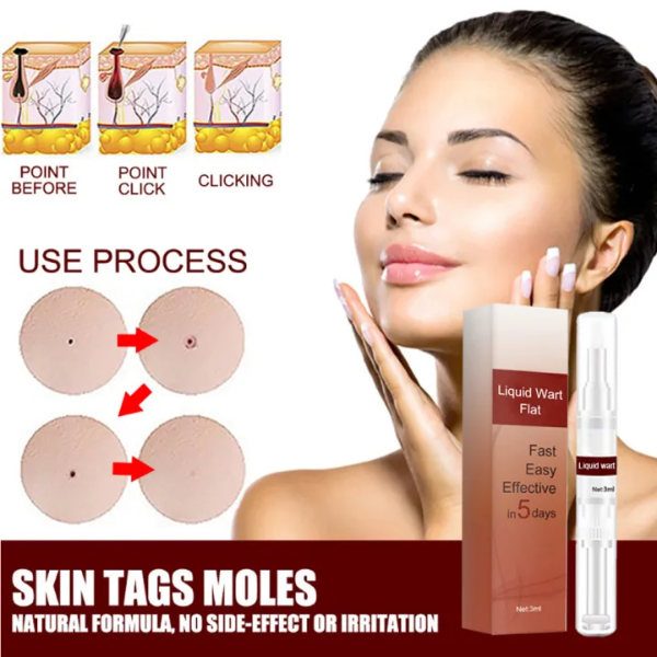 SkinClean - Tags & Moles Remover